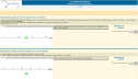 Representación gráfica de números negativos con una cifra decimal. Representación gráfica de números negativos con dos c | Recurso educativo 70921