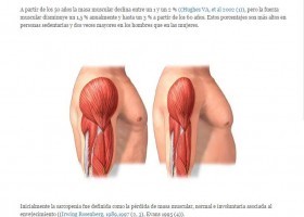 SARCOPENIA | Recurso educativo 760304